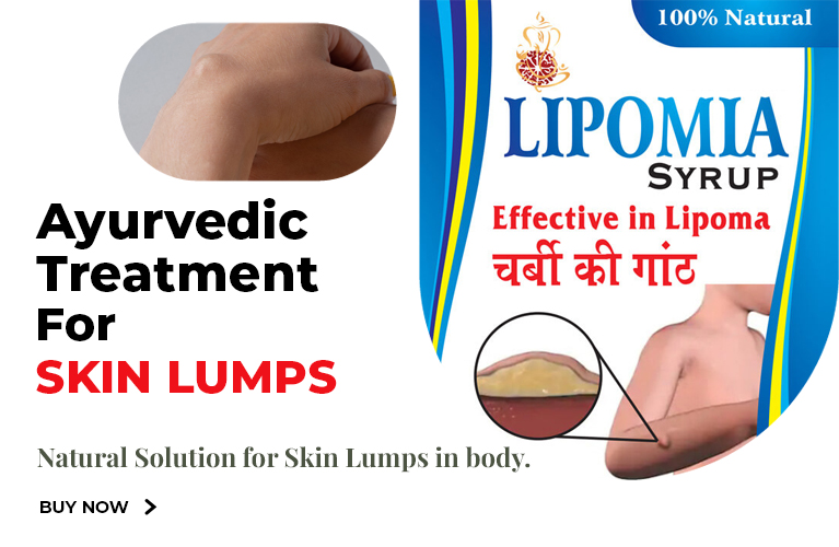 Lipomia Syrup-effective in skin lumps lipoma